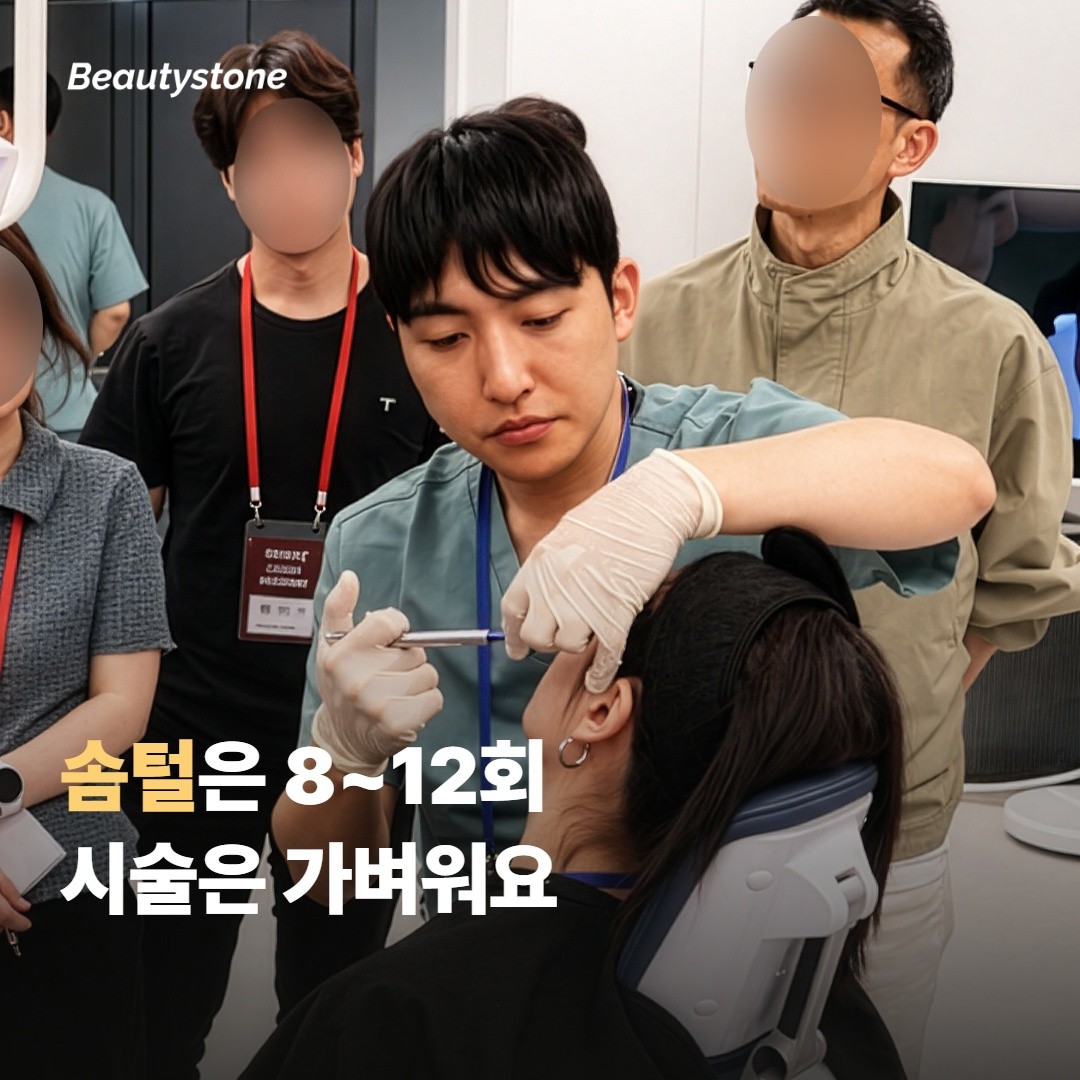 여성 얼굴 솜털은 회차가 더 들지만 시술 자체는 가벼워요