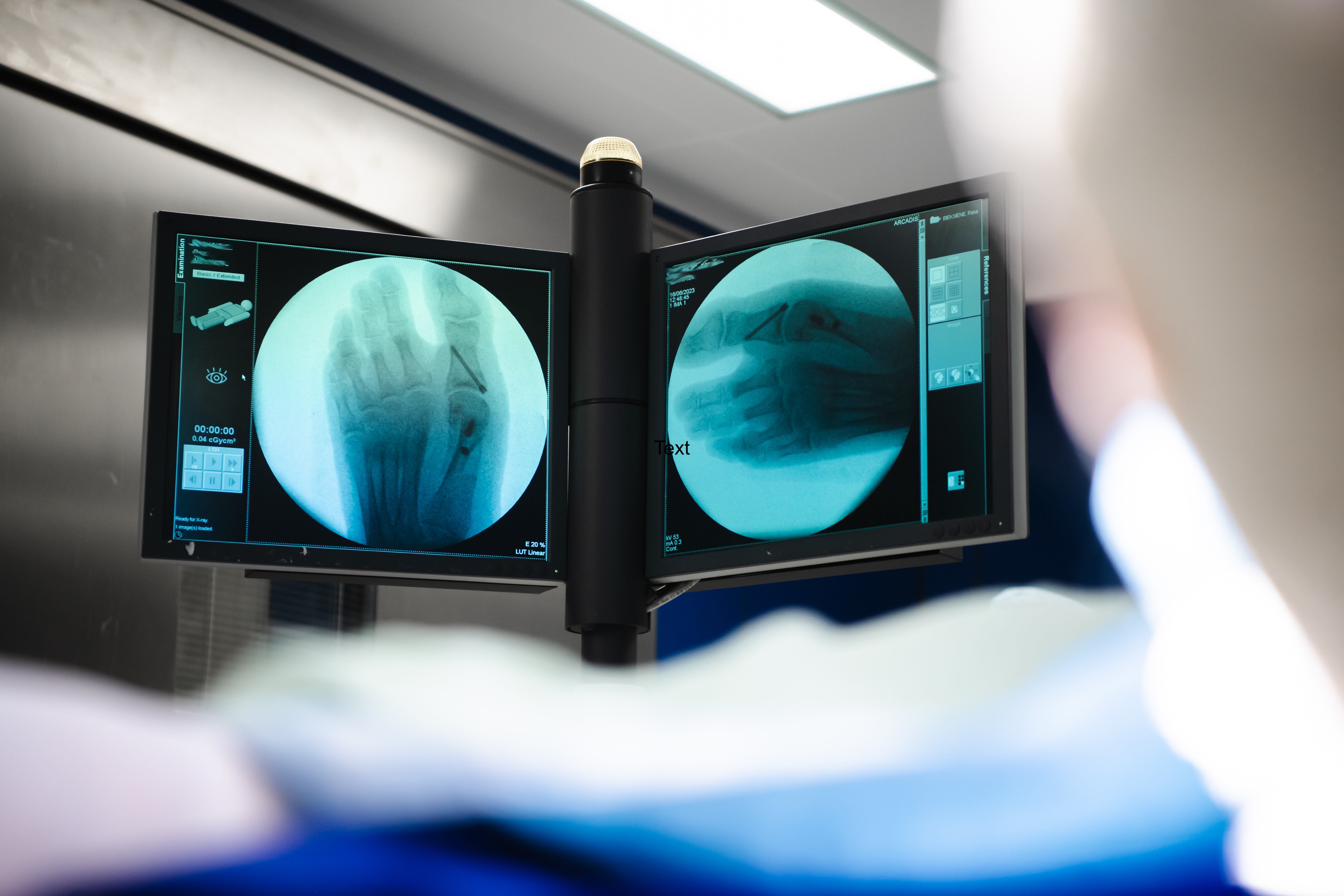Image of two screens showing images of feet, in an operating theatre.
