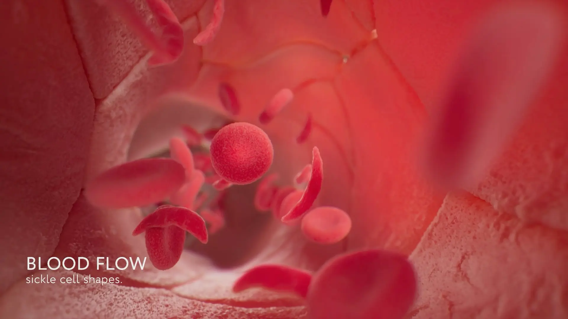 3D medical animation still from a Mainframe case study