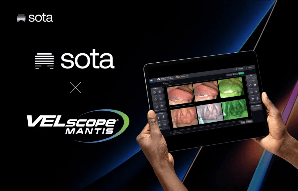 SOTA Cloud and VELscope Mentis and an image of SOTA Cloud software