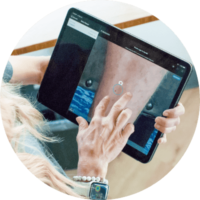 SkinIO skin cancer screening app used by Harper Health for early skin cancer detection.