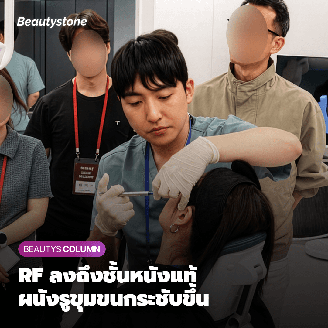 Potenza ช่วยกระชับรูขุมขนได้อย่างไร?