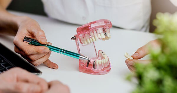 Dental implants in Toronto at Bloor Yorkville Periodontics