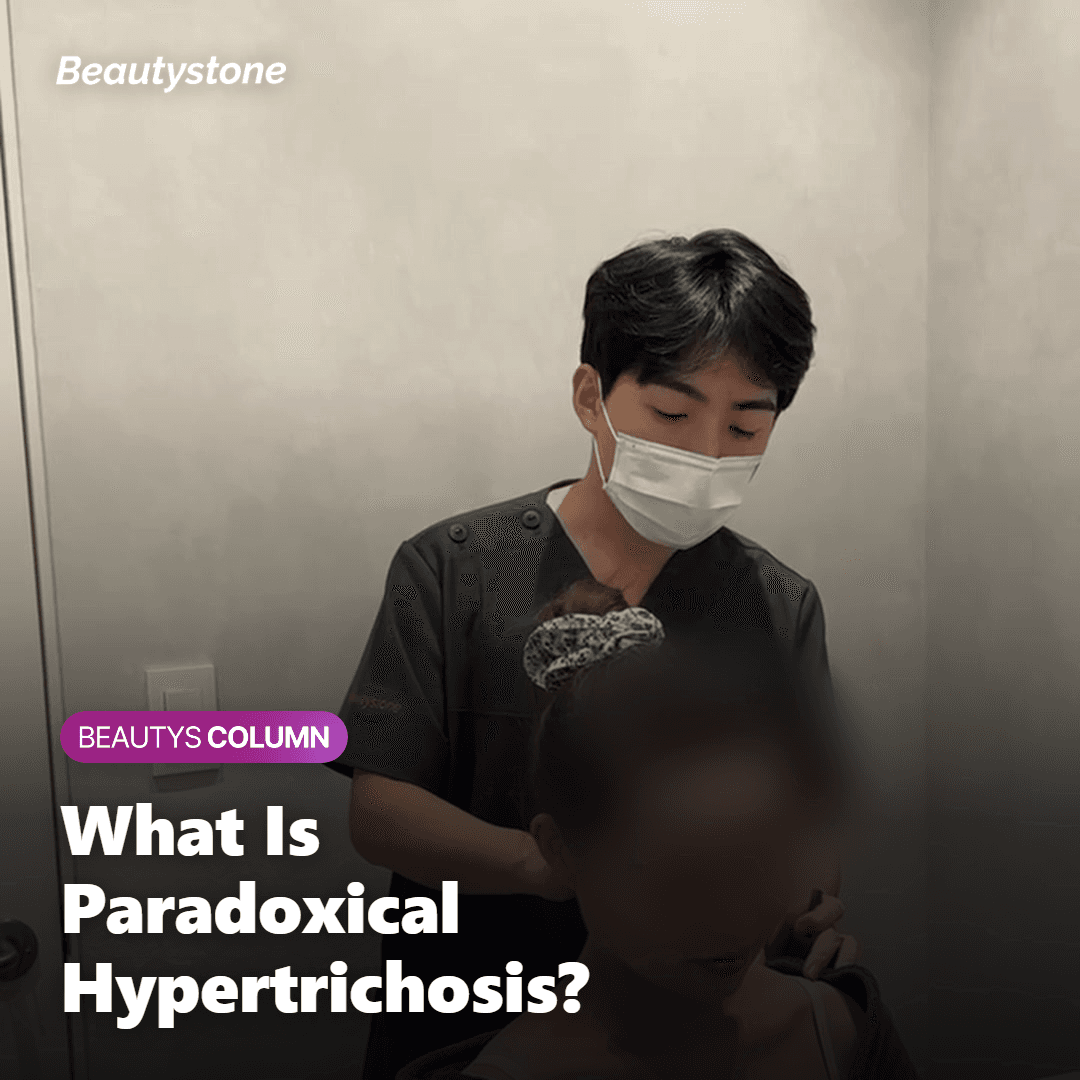 What Is Paradoxical Hypertrichosis?