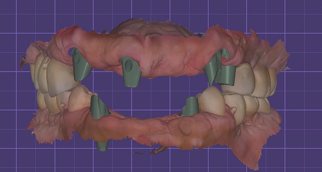 배열에따른 아이디얼한 커스텀 디자인