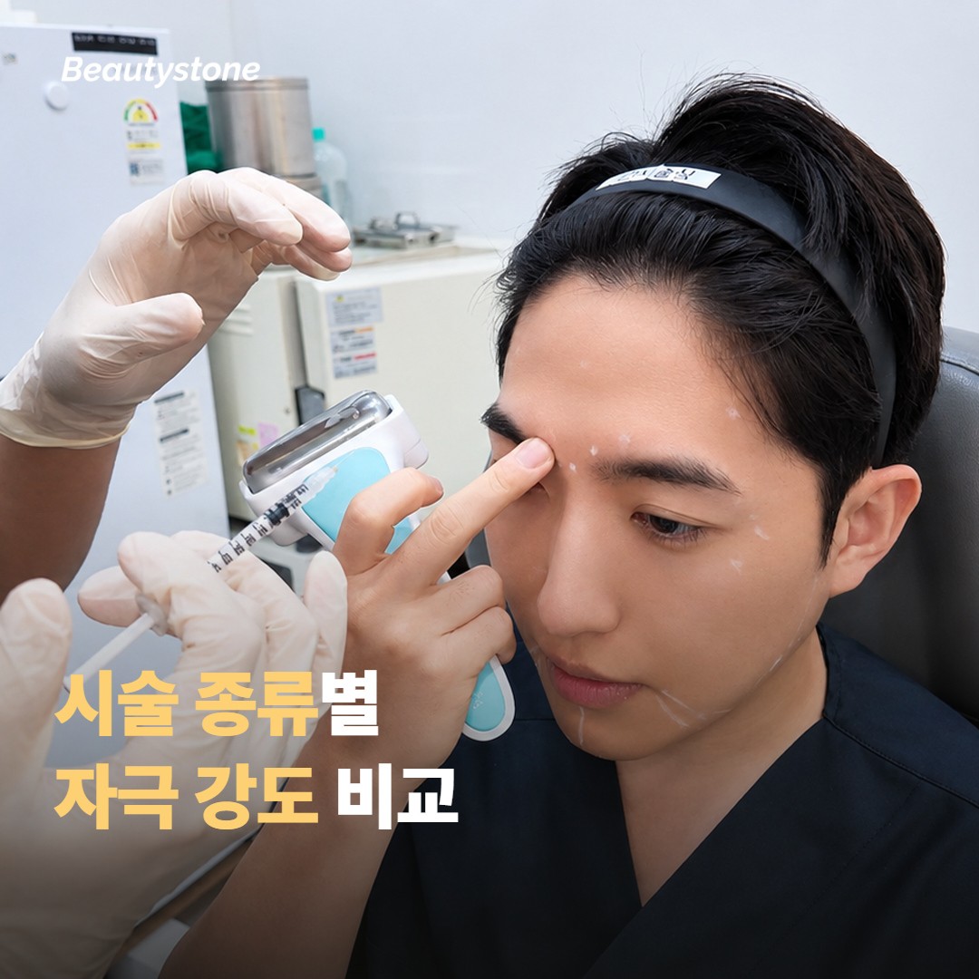 시술 종류별 자극 정도와 선택 기준