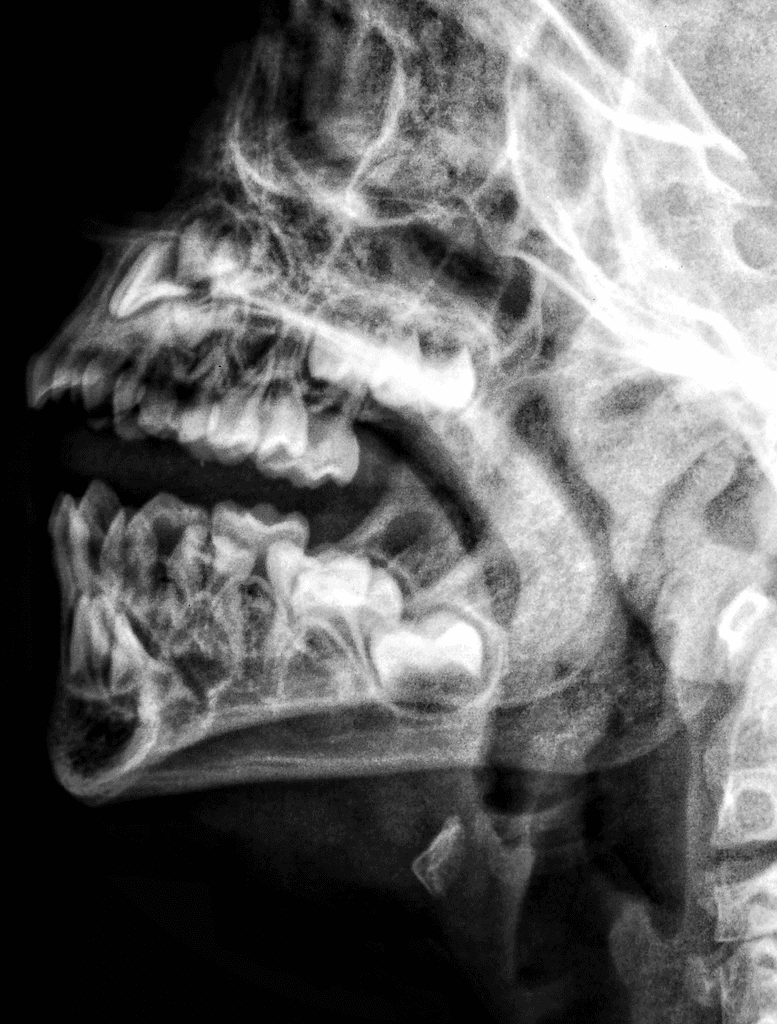 Teeth Checkup