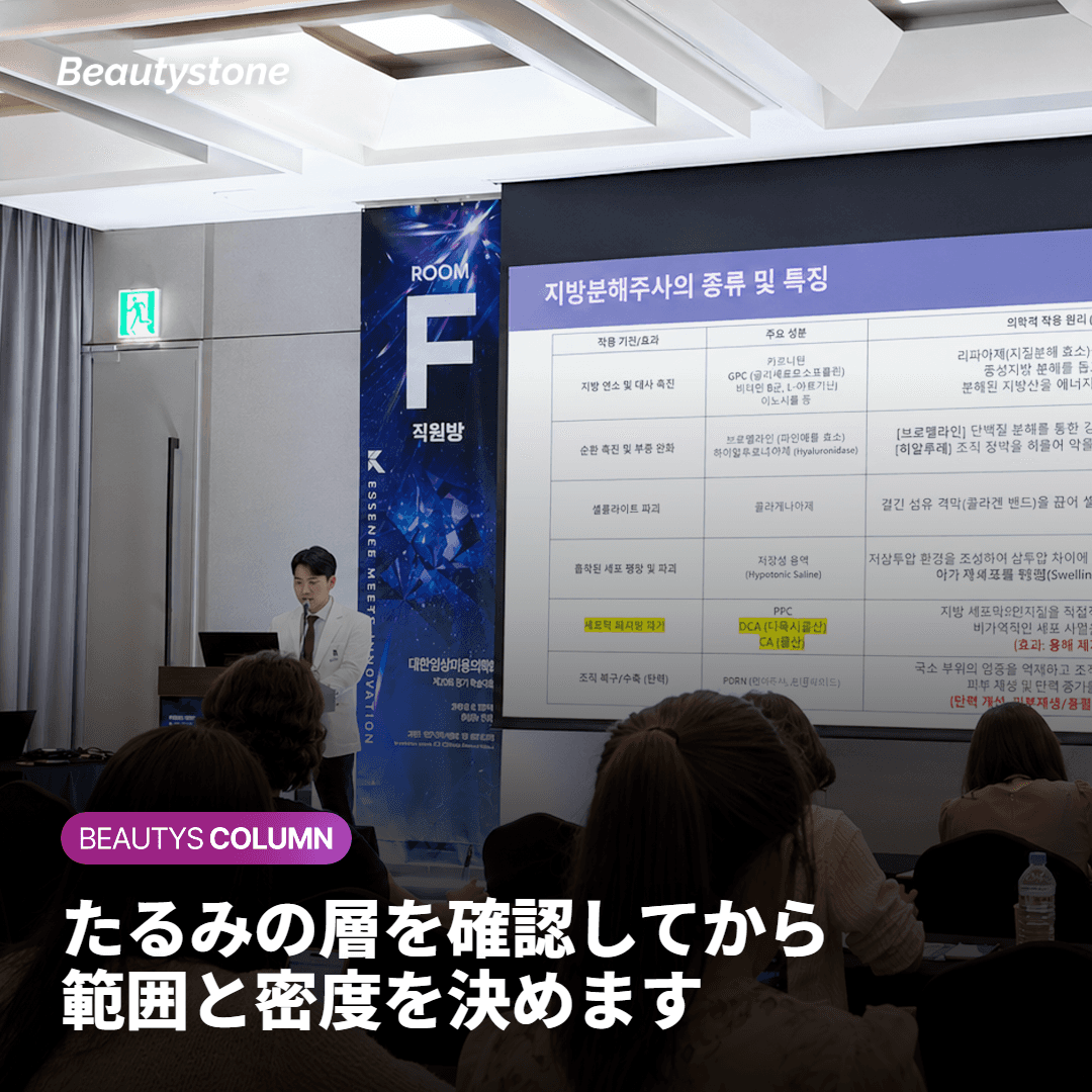 合井Beautystoneがショット数を決定する方法