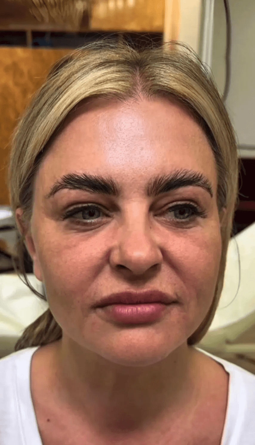 Caso 1 después del tratamiento