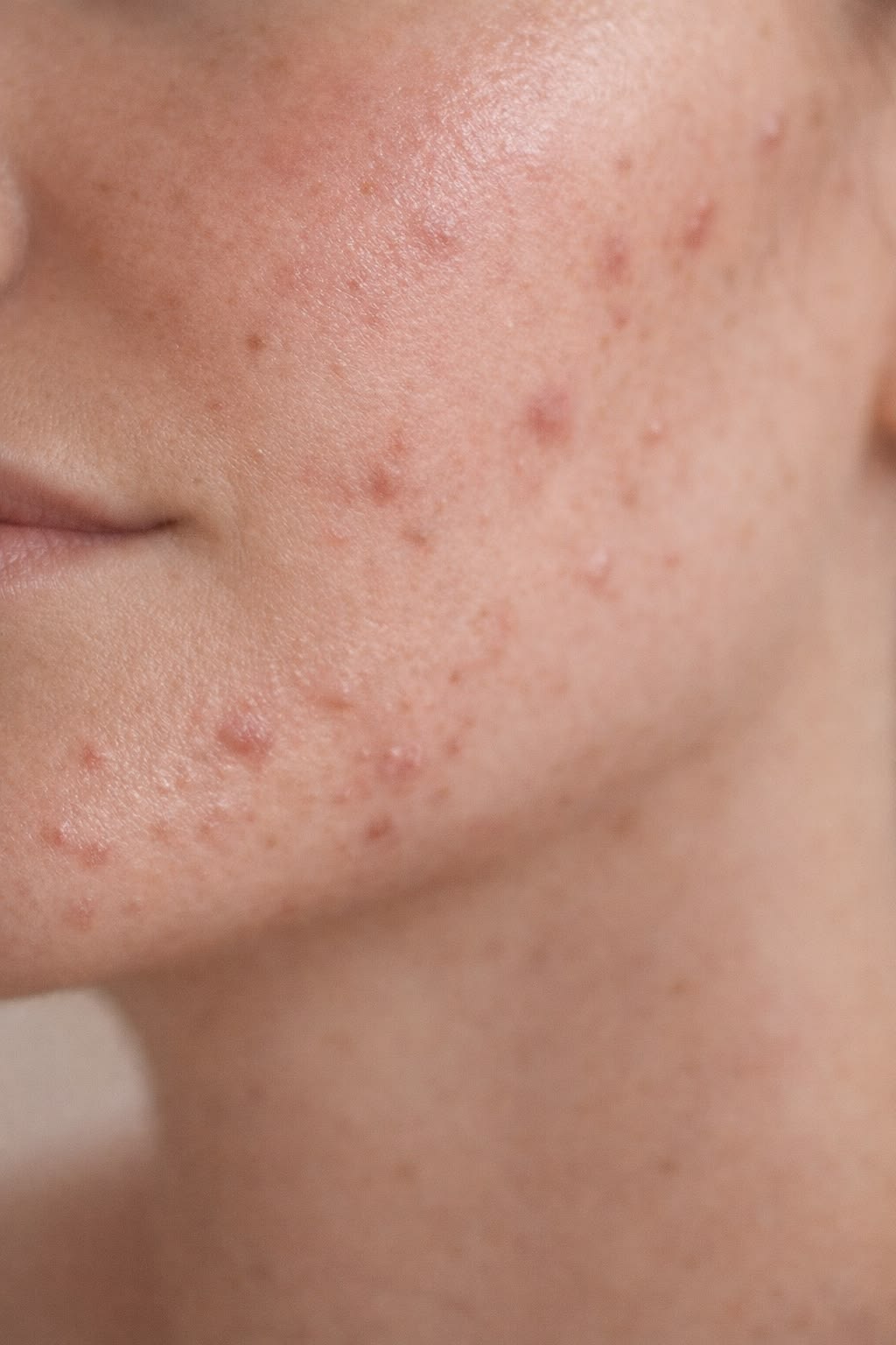 a woman with freckled hair and blue eyes