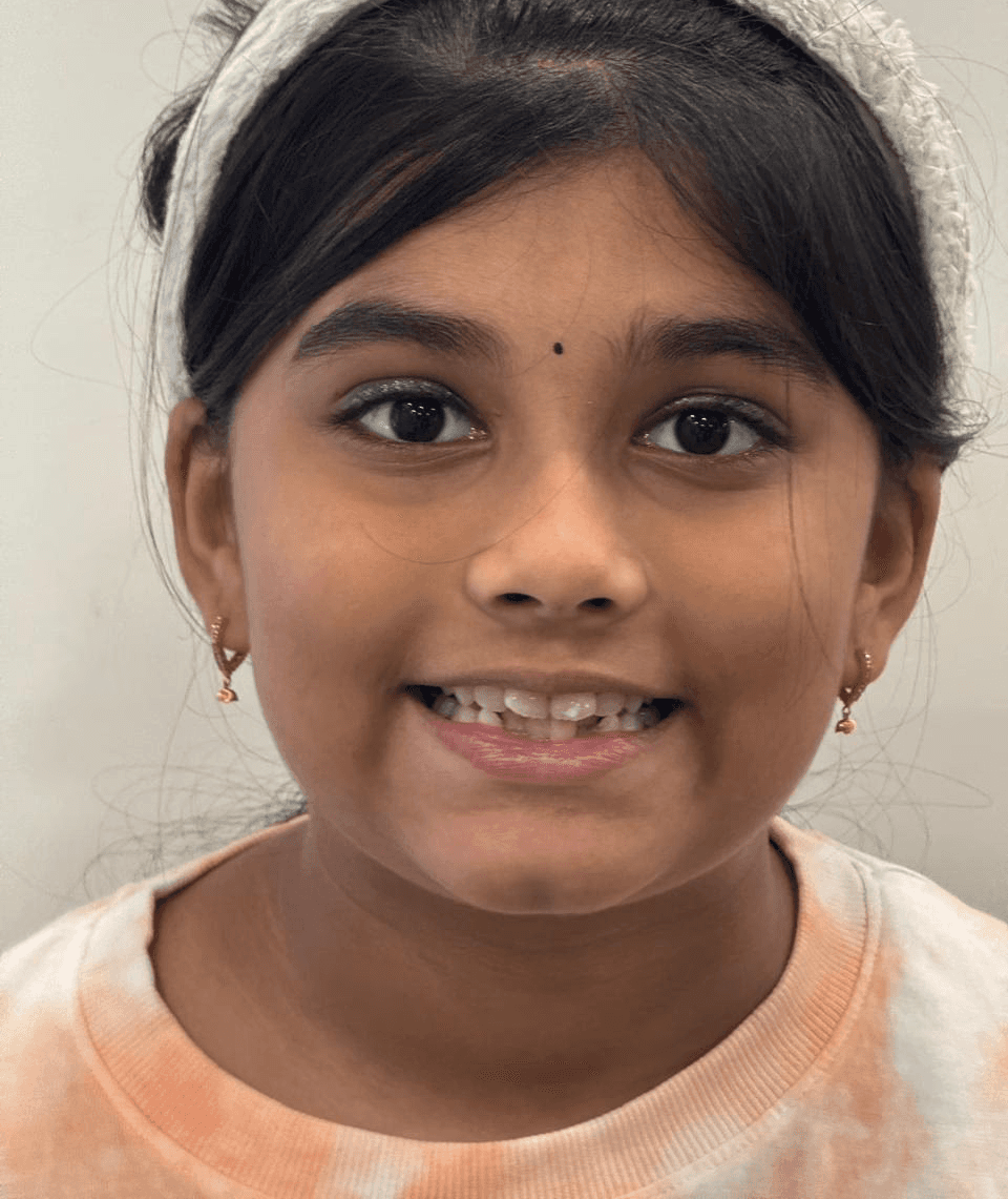 Close-up of smile showing yellowed teeth