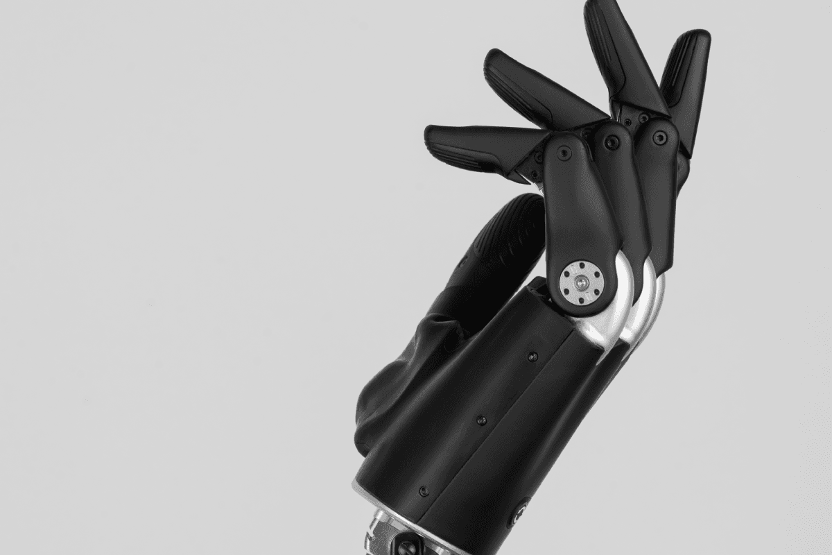 Is it a myth that advanced myoelectric prosthetic technology is completely unaffordable and out of reach?