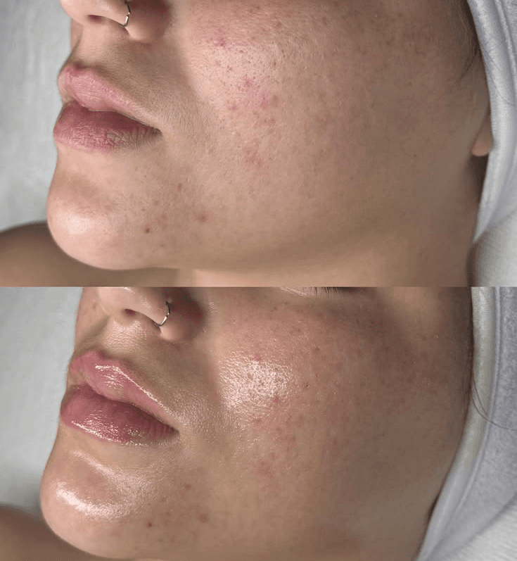 Before and after lash extension comparison, natural to full volume.