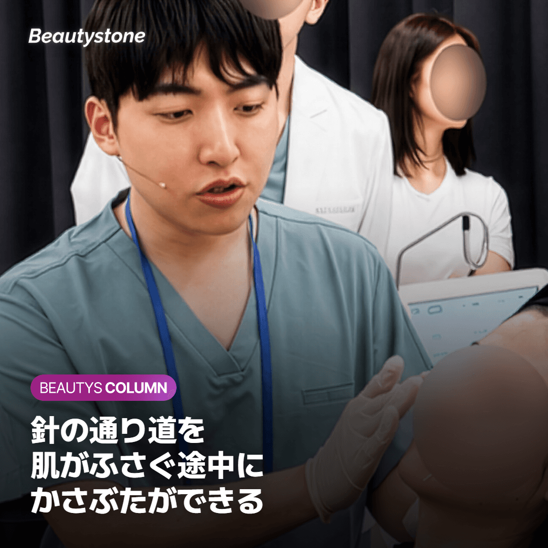 シークレットRFでかさぶたができる仕組みは？