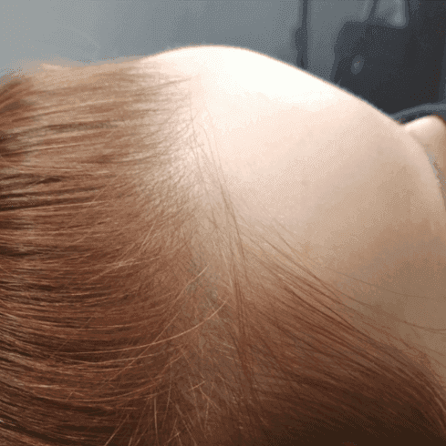 Hair After