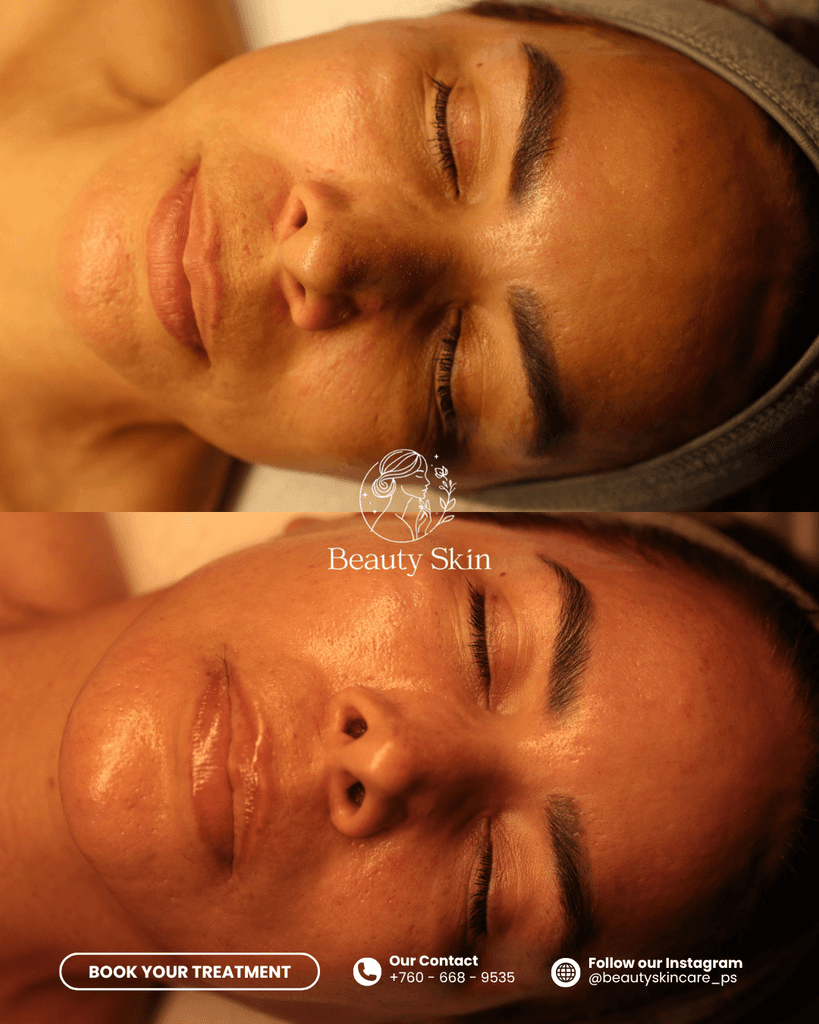 Person receiving a back massage