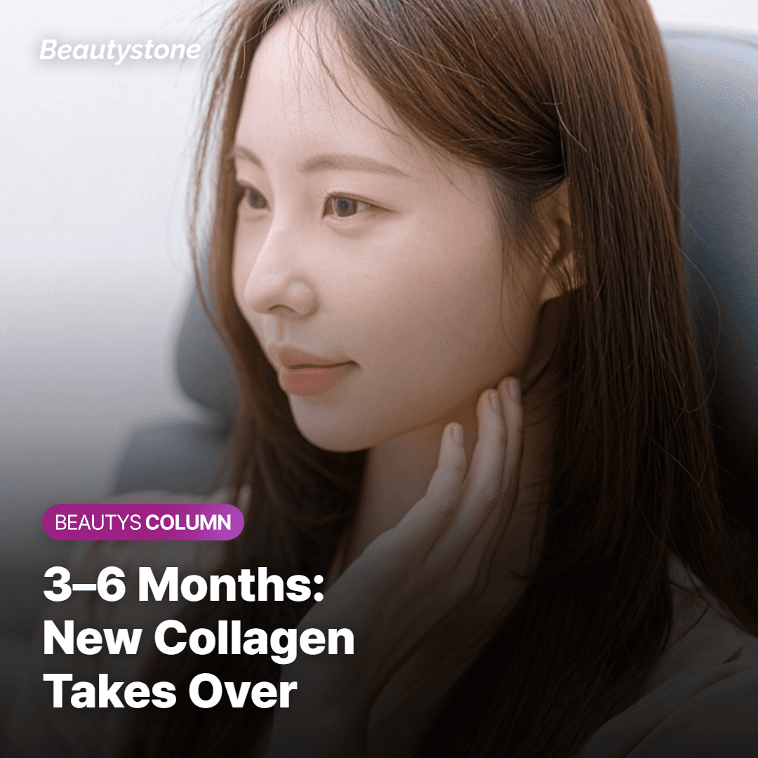 The Second Effect: Collagen Remodeling Takes Months