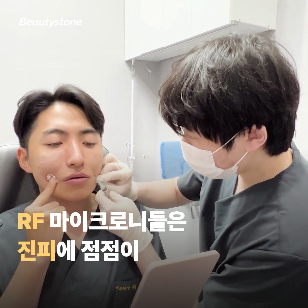 RF 마이크로니들은 진피층에 점점이 열을 박는 방식이에요