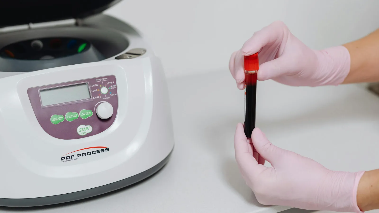 What Causes Low Monocyte Count?