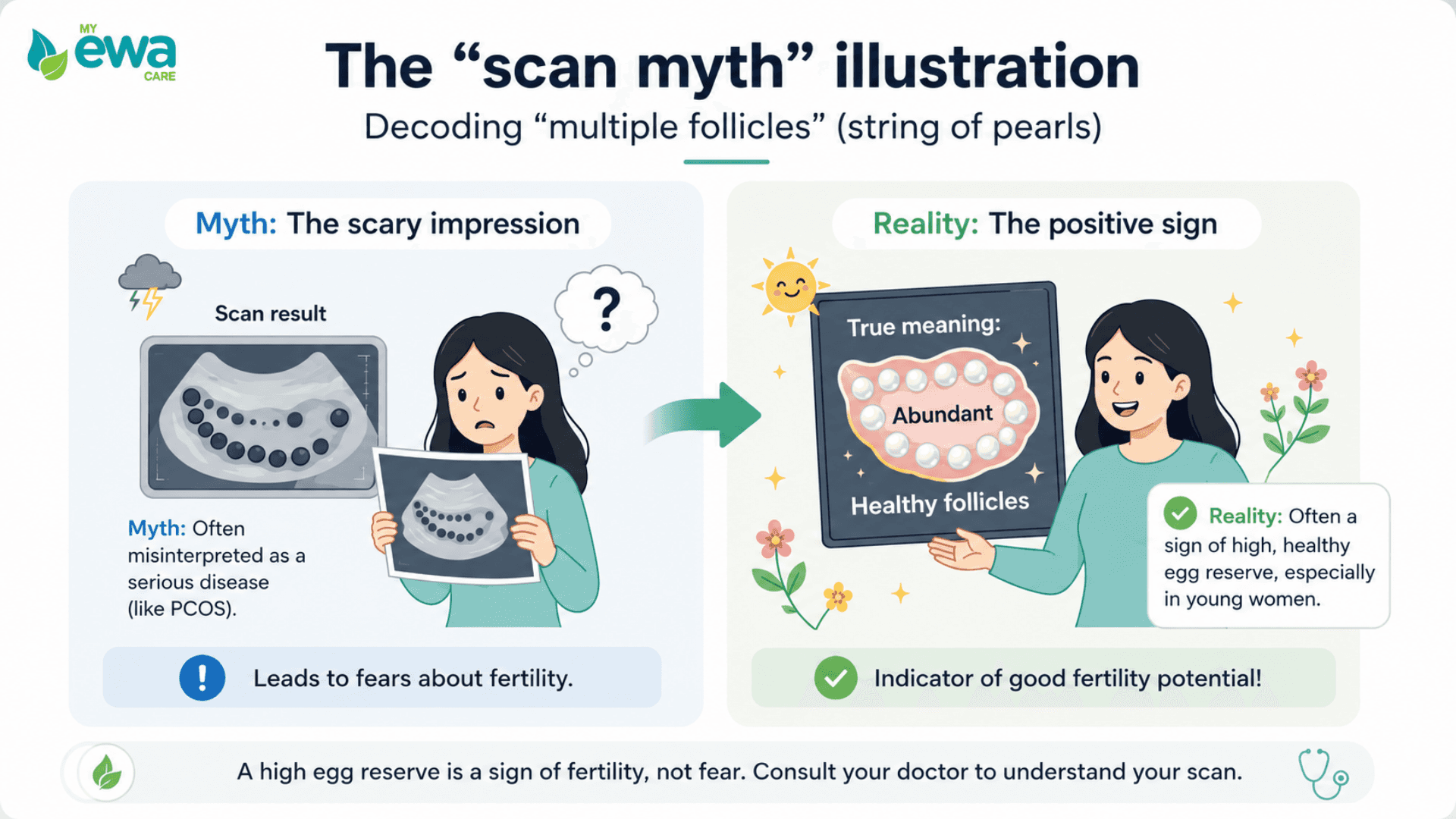 Reality of pelvic ultrasound for PCOS 