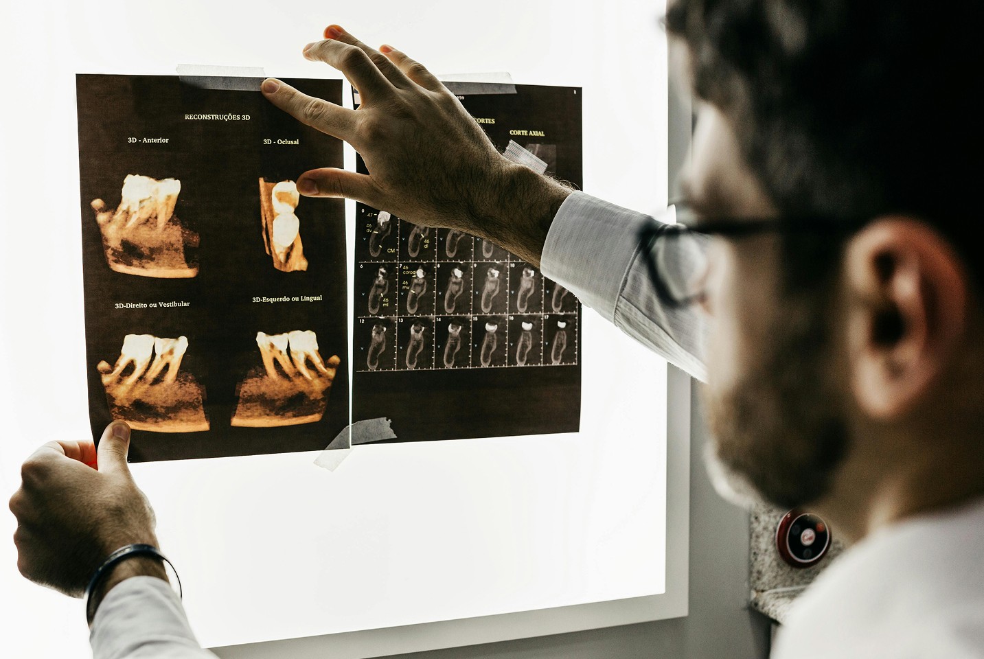 Dentist reviewing printed 3D dental reconstructions and X-ray images on a lightboard, holding the films in place with both hands.