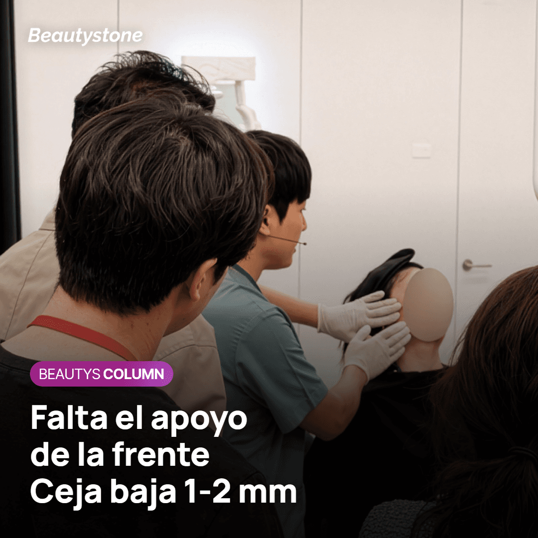 El mecanismo: desaparece la mano que daba apoyo