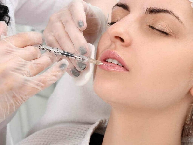 Filler tan một phần