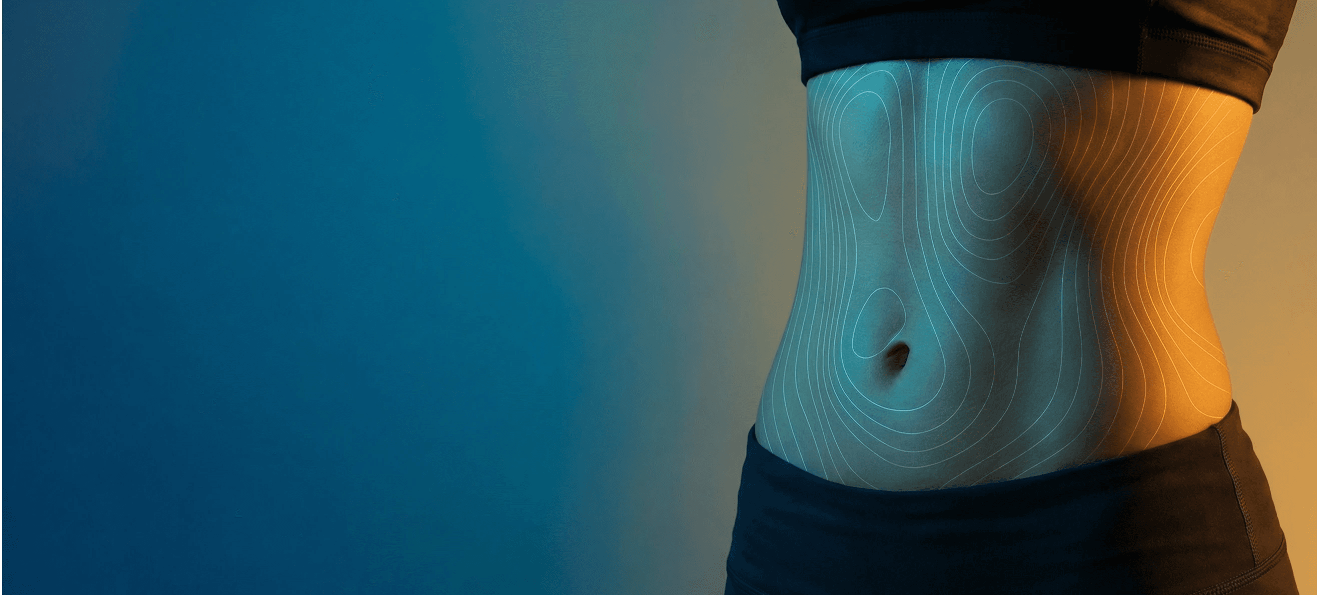 شفط الدهون بتقنية MILA بواسطة الدكتور ميغيل برافو في أبوظبي