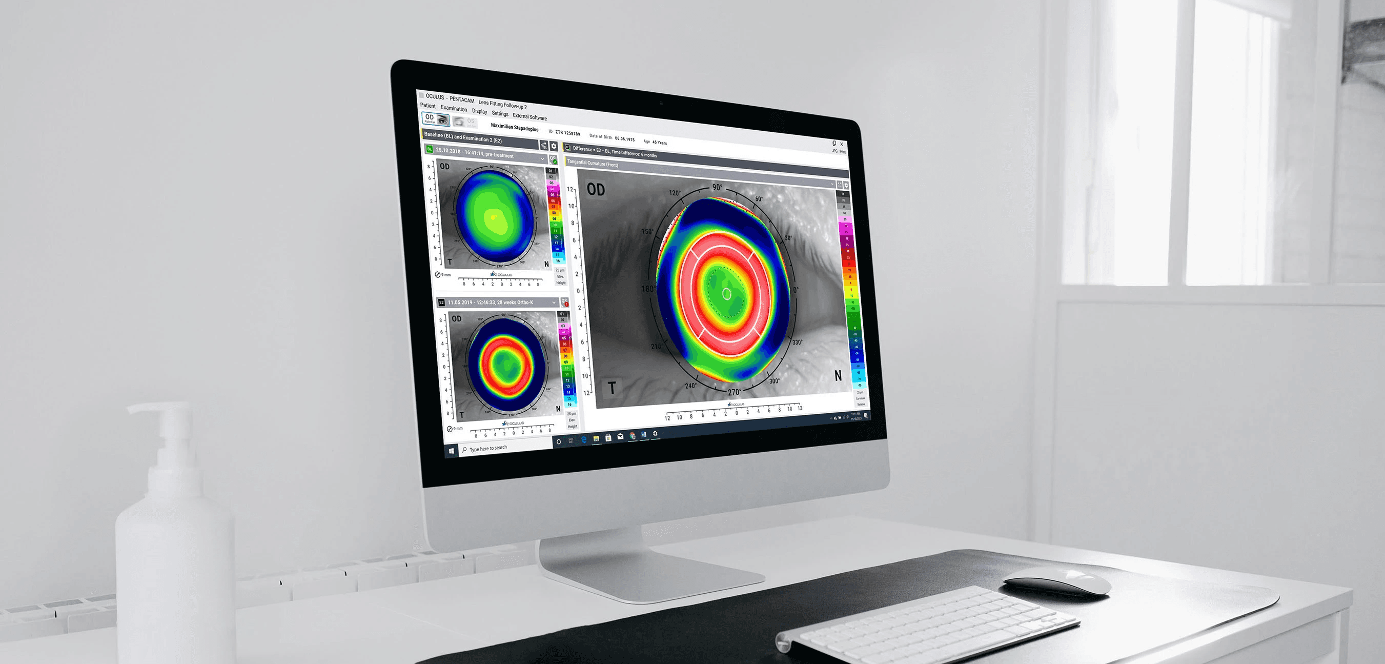 A monitor in a medical office displaying an open program with three color-coded eye examination charts.