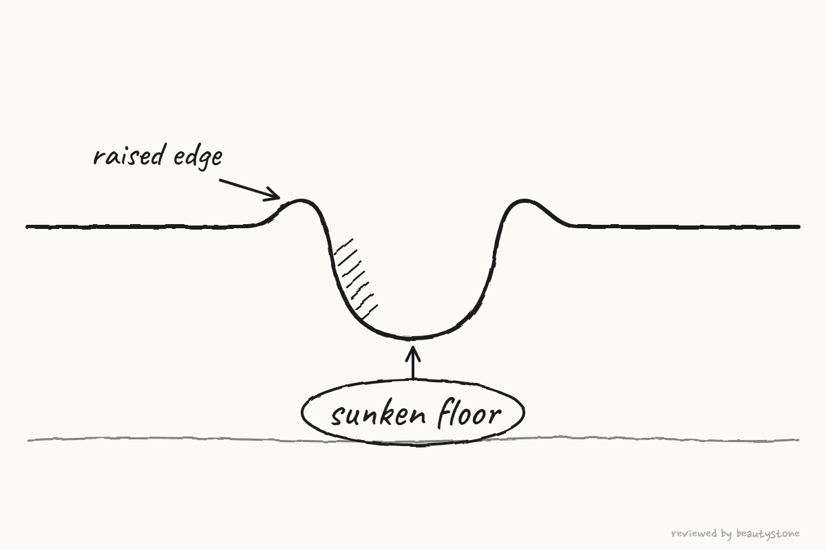 Pen drawing of a scar cross-section with a sunken floor