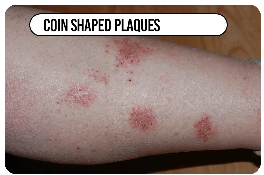 Coin-shaped plaques
