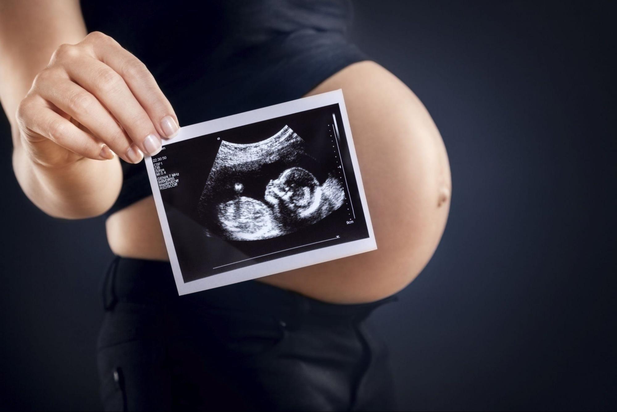 Fetal Anomaly Scan