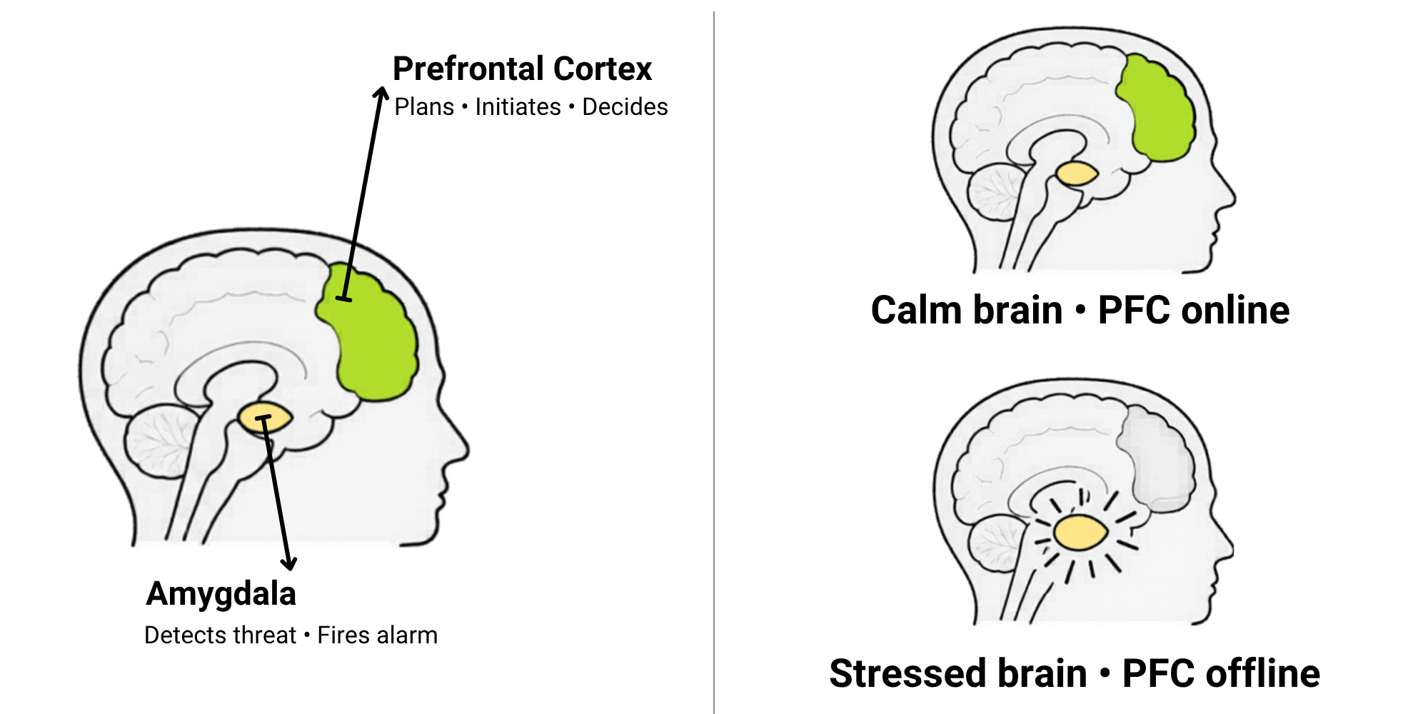 Overactive amygdala vs normal amygdala