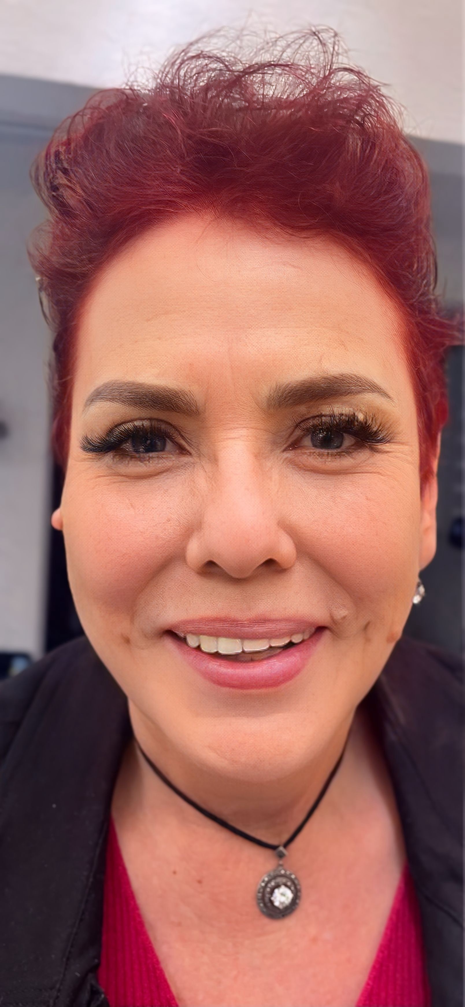a beautiful woman getting her lips done