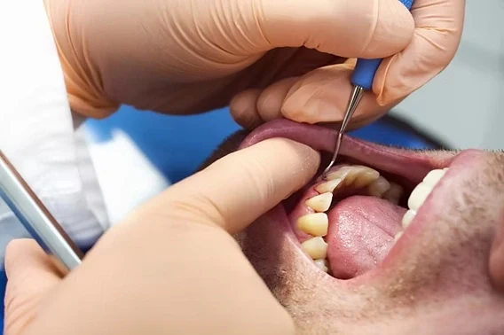periodontal dental services