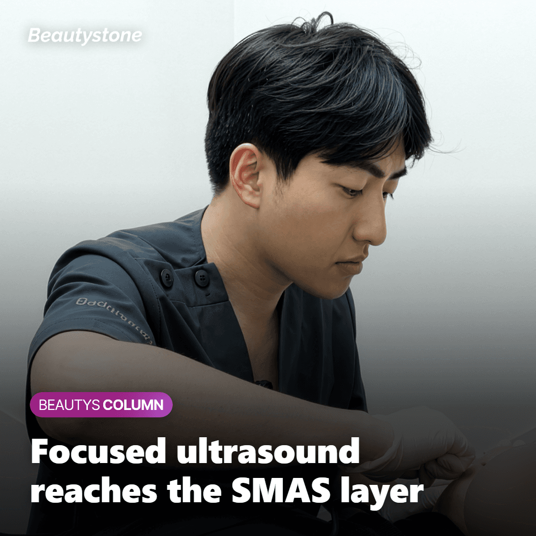 How Ultherapy focused ultrasound works on the SMAS layer