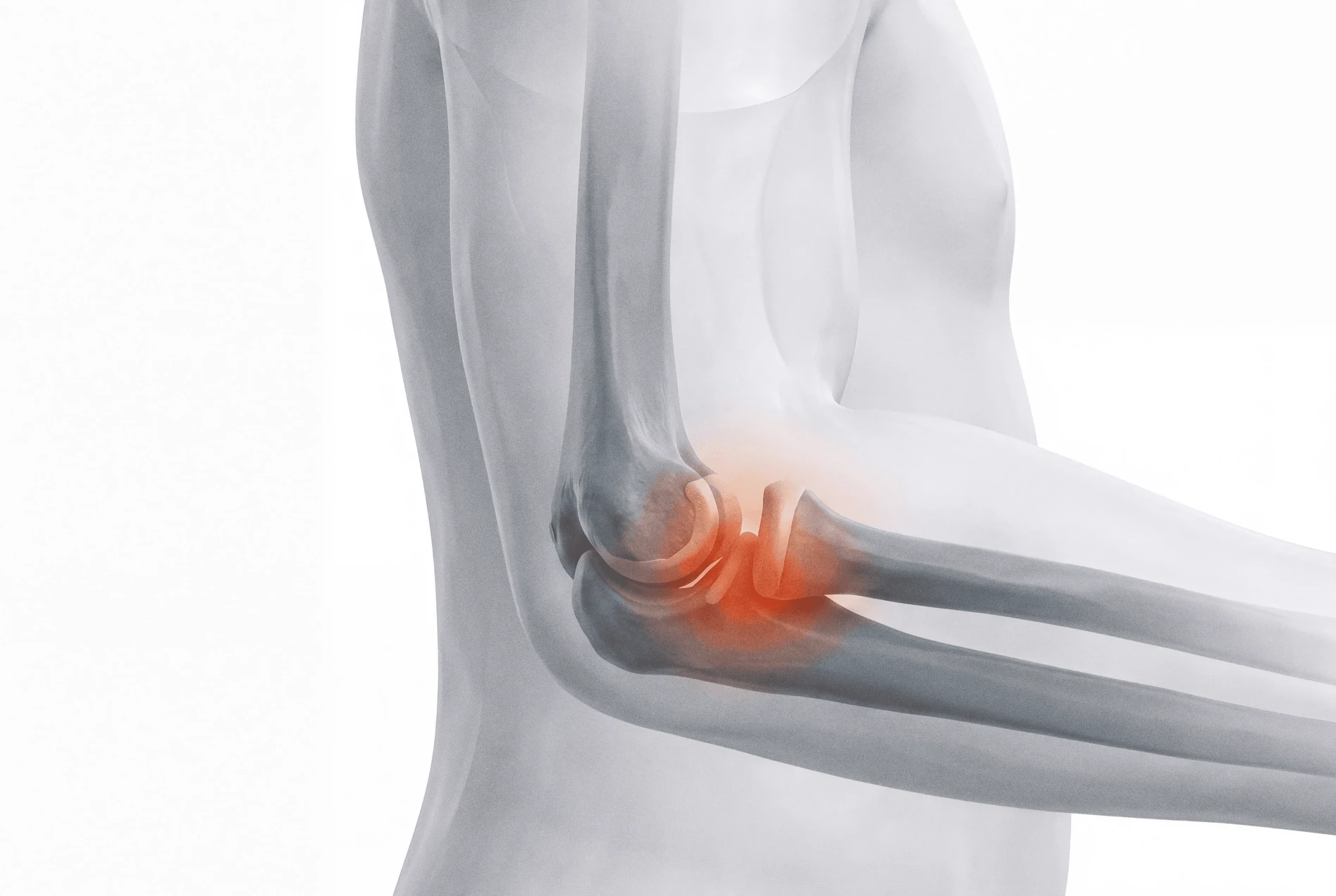 Child Pulled Elbow