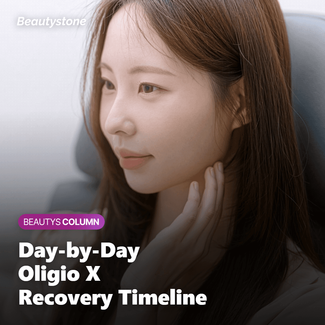Day-by-day Oligio X downtime and recovery chart