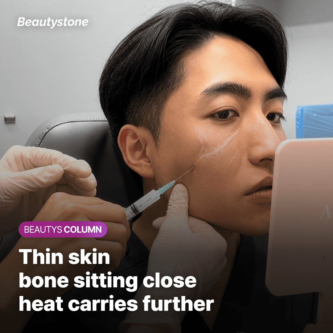 Card explaining that thin skin and nearby bone let heat carry into surrounding tissue at the temple