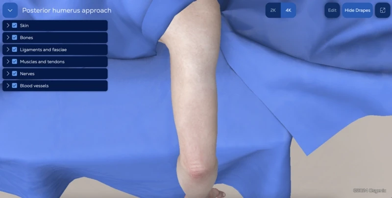 Posterior humerus approach