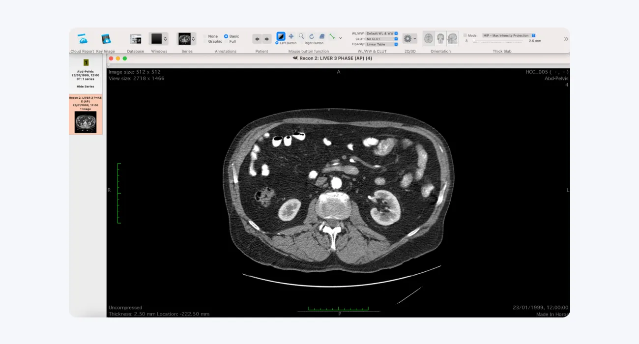  Horos: Open-source DICOM viewer for MacOS