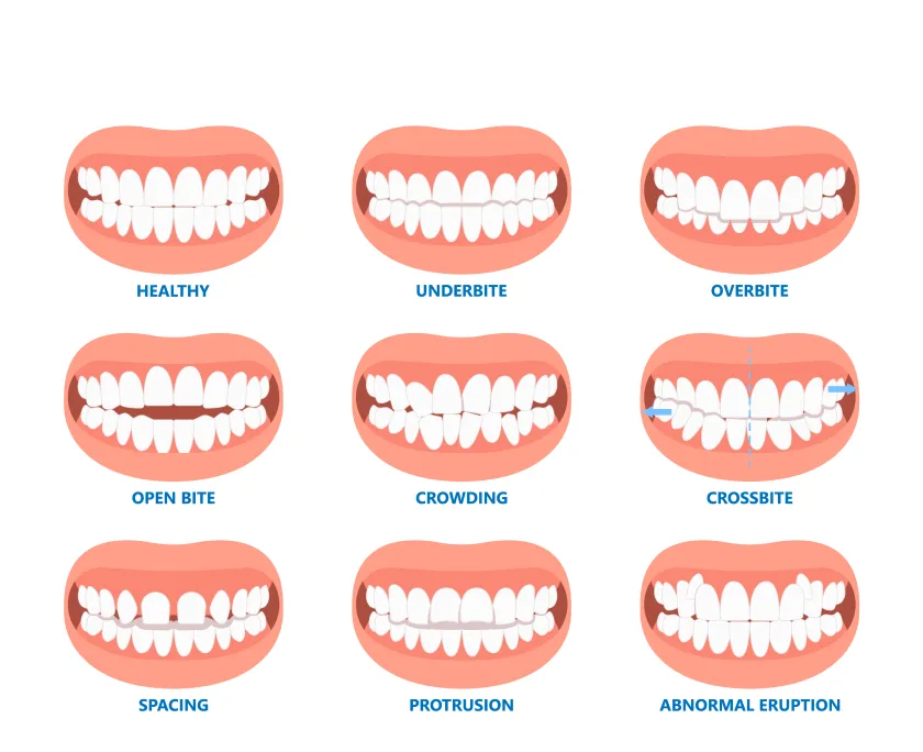 invisalign clear aligners dental