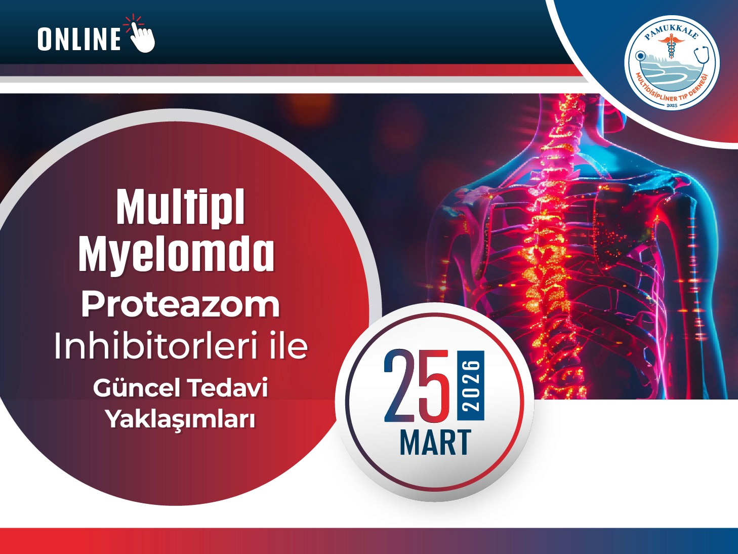 multipl-myelomda-proteazom-inhibitorleri-ile-guncel-tedavi-yaklasimlari