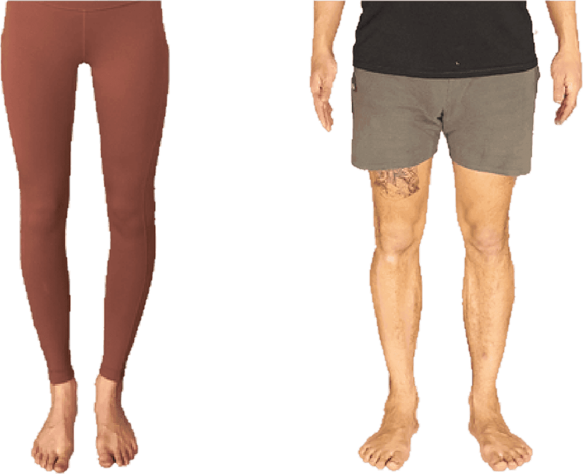 Two people's legs photographed side by side in standing, showing visibly different neutral leg shapes.