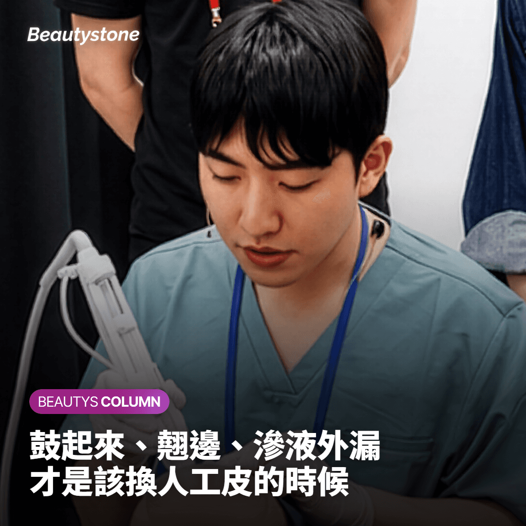 人工皮(DuoDERM)只在鼓起時才揭下