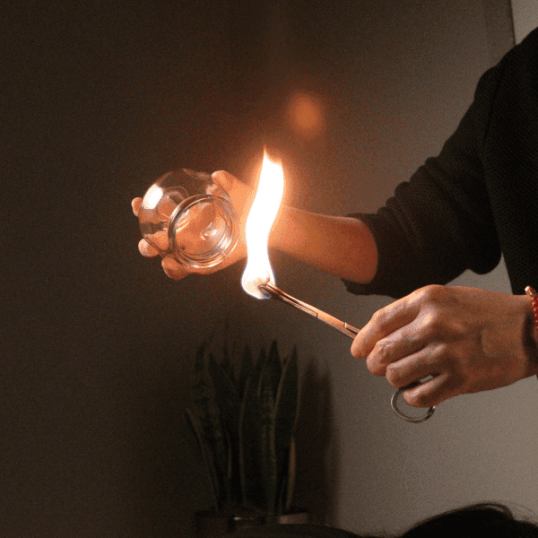 lighting up a cotton swab for fire cupping acupuncture