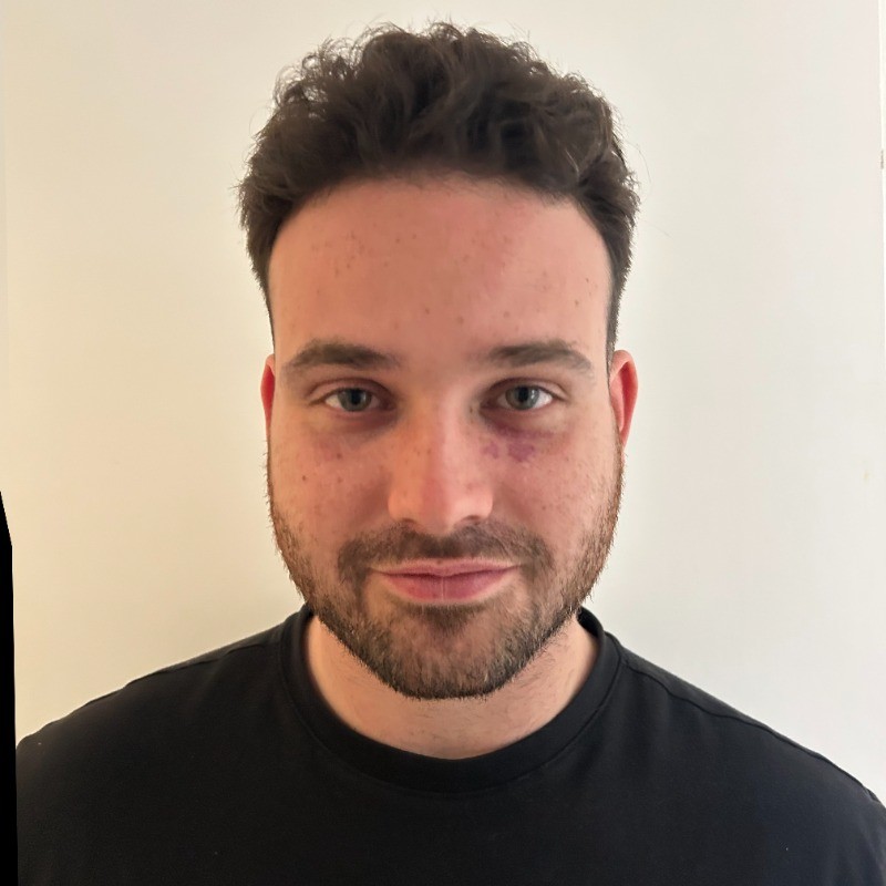 Uomo con un occhio nero. Ritratto sorridente.