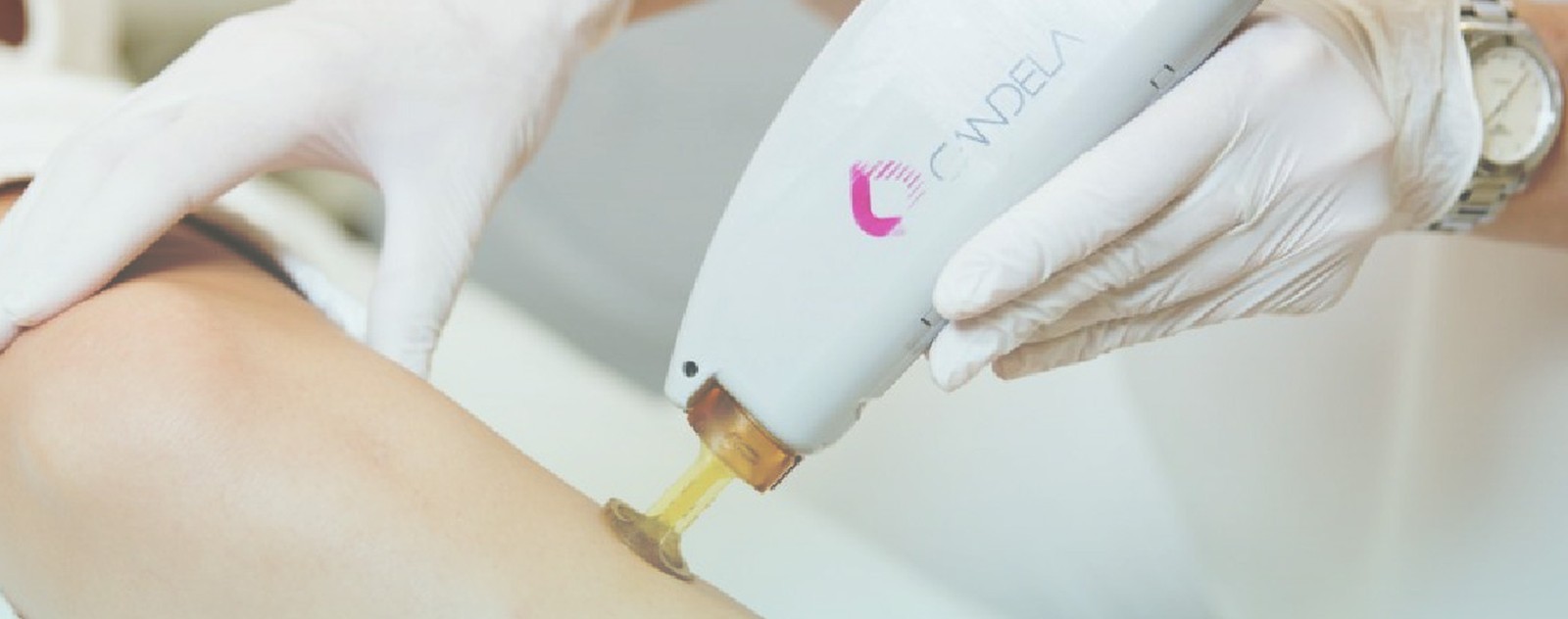 Laser Hair Removal at Aether Aesthetics, a medical spa in Rockville, Maryland