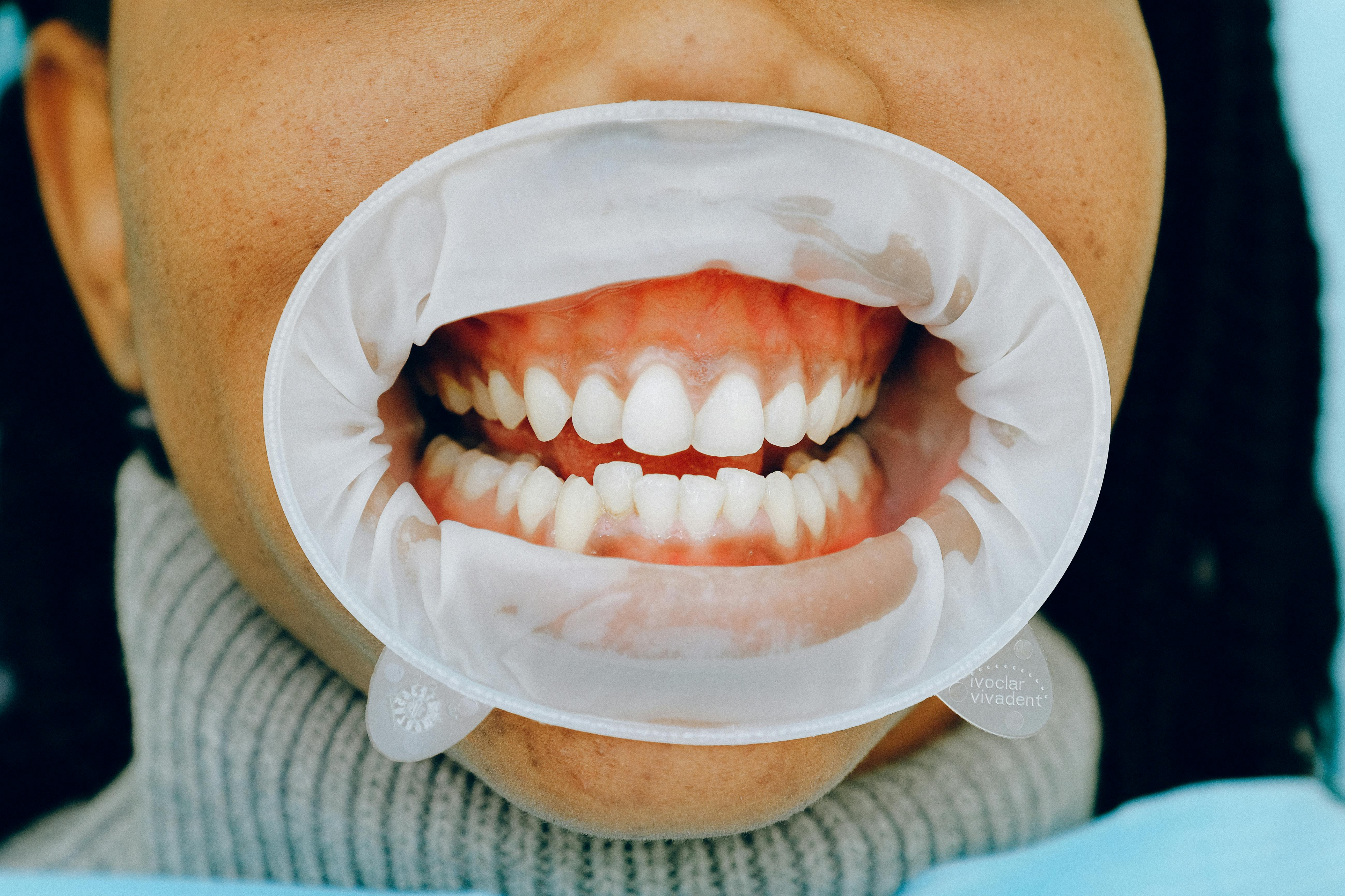 closeup of a womans smile