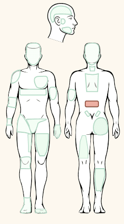 body map